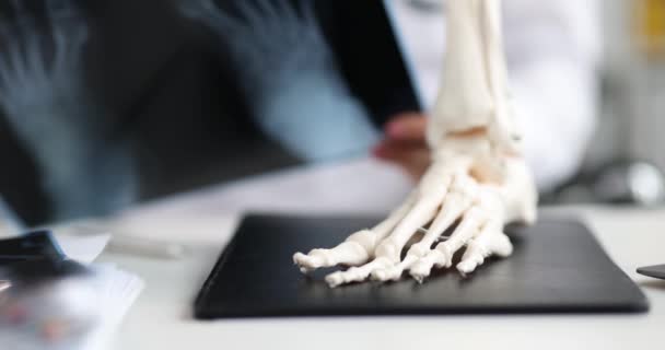 X-ray image and mockup of skeleton of patient foot — Stockvideo