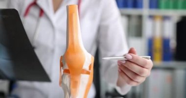 Traumatologist examining x-ray and showing problem on anatomical model of knee closeup 4k movie
