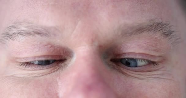 Primer plano de los ojos masculinos con estrabismo convergente 4k película — Vídeo de stock