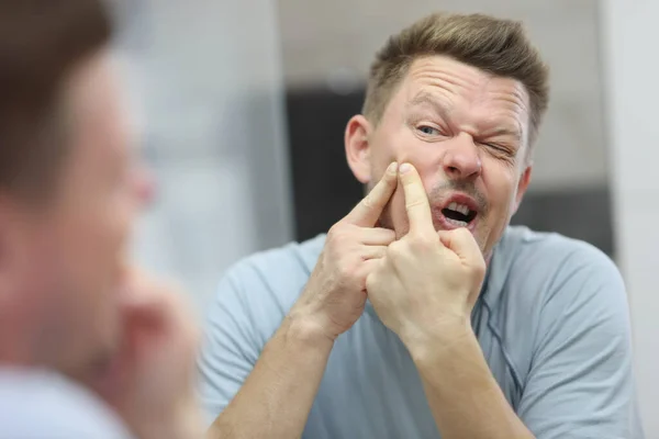 Man squeeze and get rid of pimple on face looking in mirror — Photo