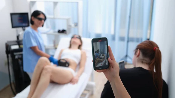 Smm manager filming laser hair removal video on mobile phone for social media ads closeup — ストック写真