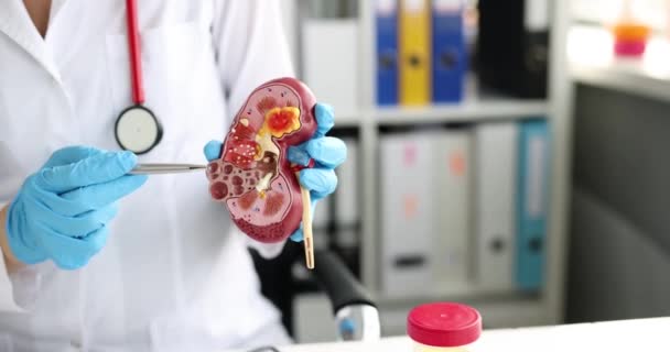 Nephrologist holding model of human kidney in clinic — 비디오