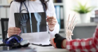 Doktor travmatolog, 4K filminde hastanın elinin röntgenini arıyor.