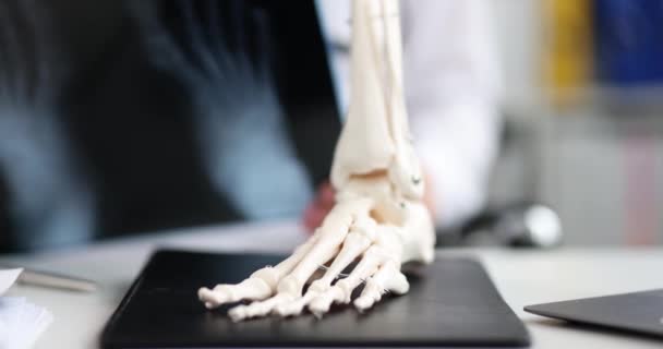 医生在人体小腿特写4k电影模型的背景下观察脚部的X光照片 — 图库视频影像