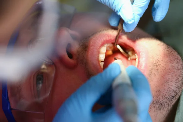 Dokter gigi memperbaiki gigi yang rusak, janji di klinik perut, mendapatkan gigi tetap — Stok Foto