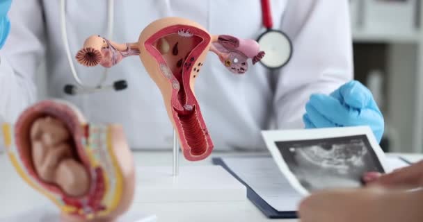 Modello dimostrativo del sistema riproduttivo femminile del ginecologo nelle cliniche primo piano — Video Stock