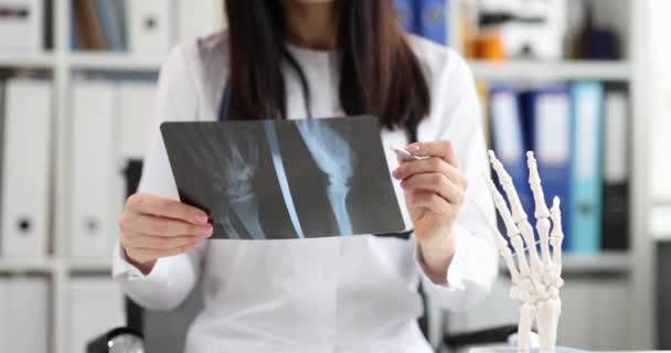 Médico profesional que realiza diagnósticos de rayos X de huesos de manos en clínica — Vídeos de Stock