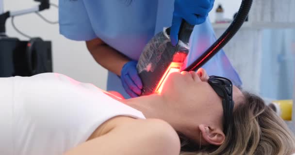 Elos epilering hårborttagning förfarande på kvinnligt ansikte — Stockvideo