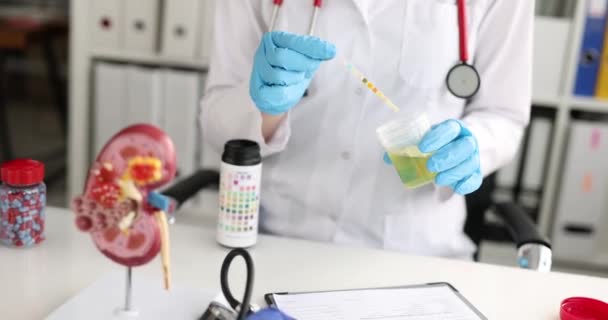 Doctor Holds Test Tube Urine Sample Analysis Examination Kidneys Diagnosis — Stock Video