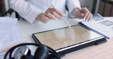 Kardiyolog kardiyoloji kliniğindeki tablette elektrokardiyogramı inceliyor. İskemik kalp hastalığı semptomları ve tedavi konsepti