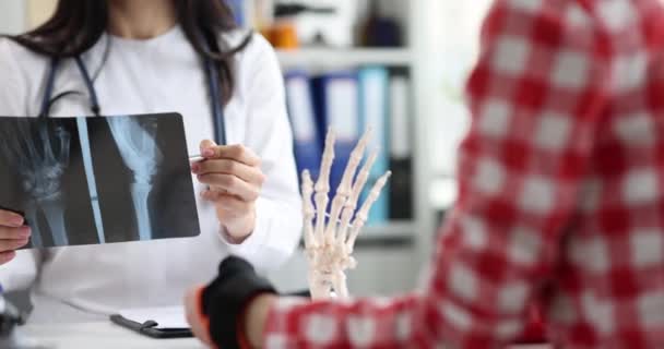 外科医生仔细检查腕部的X光检查并作出诊断 创伤学和保健概念 — 图库视频影像