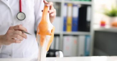 Doktor, tıbbi ofiste yapay diz ekleminin modelini gösteriyor. Diz eklemleri ve bağları hastalıkları