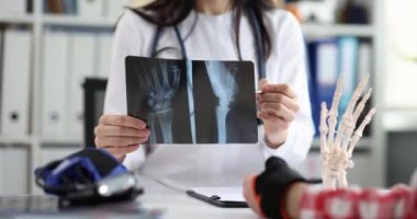 Doktorlar, el kemiği hastalığının röntgenine işaret ediyor. Ortopedik tıp ve sağlık hizmeti kavramı