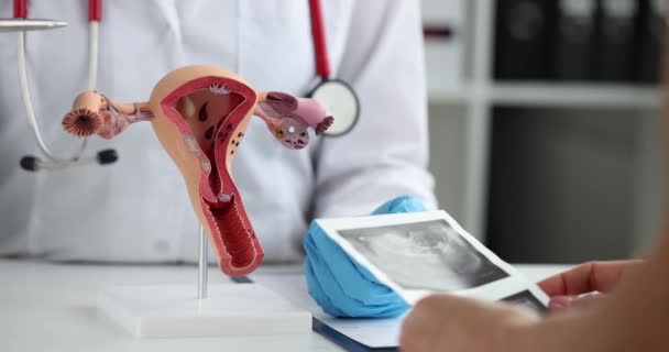 Jinekolog Ultrason Taraması Yapılan Bir Kadına Danışıyor Kadın Üreme Sistemi — Stok video