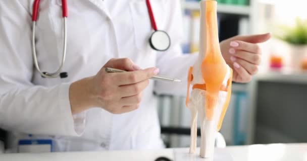 医生展示了一个医学解剖模型的膝盖 慢动作 会诊风湿科医生 — 图库视频影像