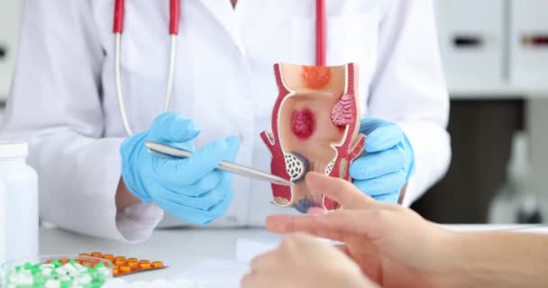 Doctor Shows Anatomical Model Anus Hemorrhoids Close Treatment Drugs Proctologist — 图库视频影像