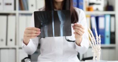 Kadın doktor bileğin röntgenini gösteriyor, yakın plan. Fraktür teşhisi, cerrahlar danışma, sağlık hizmetleri