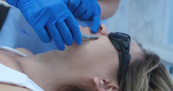 Kosmetikerin Entfernt Haare Über Frauenlippe Nahaufnahme Laserepilation Des Gesichts Schönheitsoperation — Stockvideo