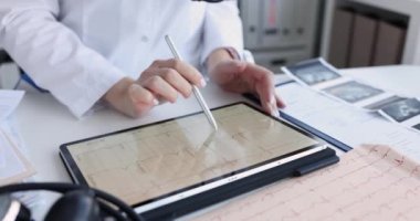 Doktor tabletin ekranındaki kardiyogramı inceliyor, yakın plan. Elektrokardiyogram, klinik çalışma