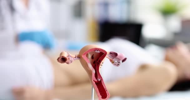妇科医生对女性生殖系统的器官进行超声波检查 子宫和阑尾的诊断 — 图库视频影像