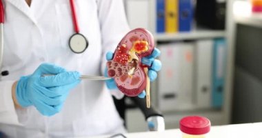 Böbrek ve böbrek üstü bezleri ameliyatı tıbbi müdahaledir. Doktor böbrek anatomisini elinde tutuyor.