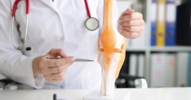 Travmatolog, klinikte bacak ve diz ekleminin modelini inceliyor. Diz eklemlerinin tedavisi