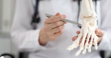 Ortopedi doktoru ayak bileğindeki iskelete bakıyor. Yerleşim bozuklukları, tedavi ve düz taban kavramı