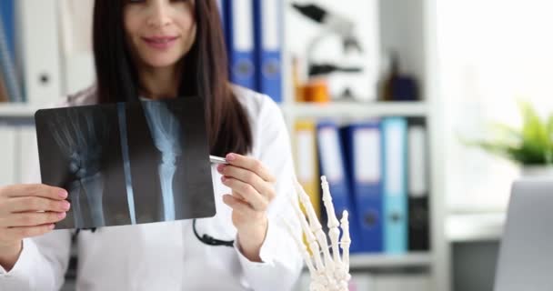 Médico Sostiene Las Manos Una Radiografía Mano Modelo Esqueleto Las — Vídeos de Stock