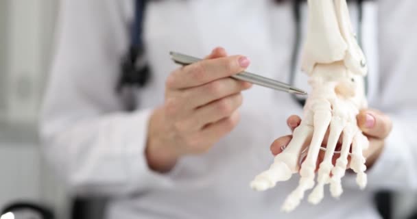 Médico Ortopédico Observa Esqueleto Del Tobillo Del Pie Trastornos Marcha — Vídeo de stock