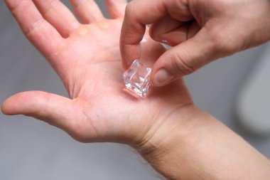 Kişi serin cilt için elinde bir parça buz tutar. Cilt konsepti için buz