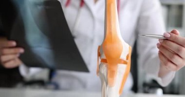 Klinikteki hastanın diz eklemlerinin röntgenini çeken doktor. Diz sorunu ve eklem iltihabı kavramı