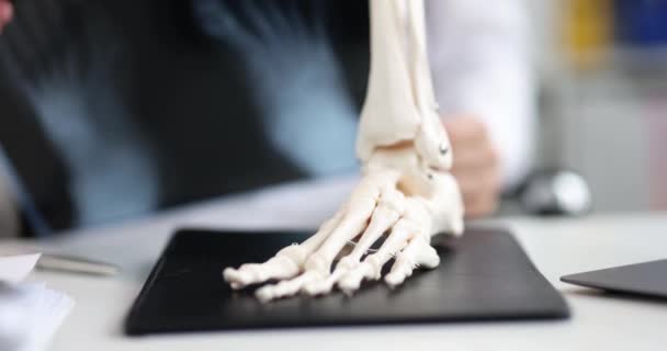 Chirurgul Traumatic Evaluează Radiografiile Picioarelor Simptomele Piciorului Scheletal Conceptul Tratament — Videoclip de stoc
