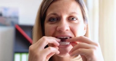 Kadın diş ısırığını düzenlemek için plastik diş kapağı takıyor. Yetişkin kavramında ısırığı düzeltmek için büyük harf