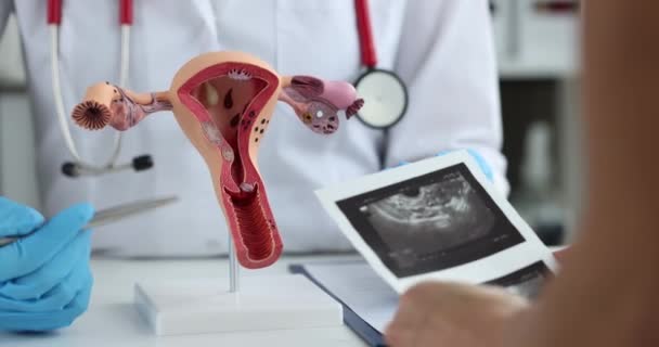 Ginecólogo Demuestra Modelo Sistema Reproductivo Femenino Mujer Joven Primer Plano — Vídeos de Stock