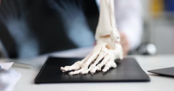 Travma Cerrahı Bacak Röntgenlerini Inceler Skelet Ayak Semptomları Tedavi Konsepti — Stok video