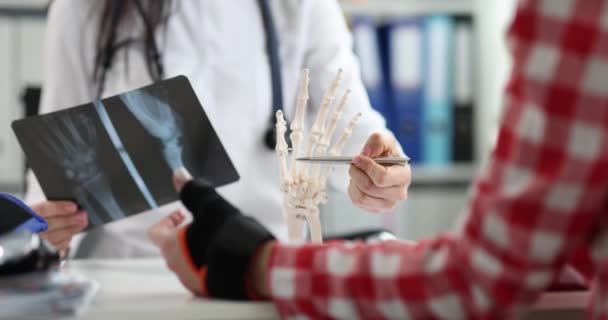 Ортопед Показывает Рентгеновскую Анатомию Кисти Пациента Клинике Концепция Повреждения Рук — стоковое видео
