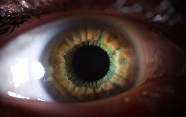 Nahaufnahme Eines Weiblichen Graugrünen Auges Mit Kontaktlinse Diagnose Und Korrektur — Stockfoto