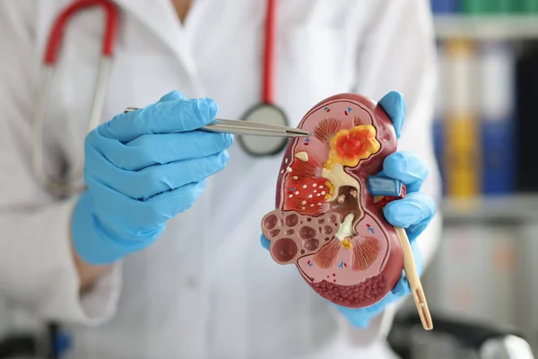 Urology and treatment of kidney diseases. Doctor performing a kidney examination on a female patient with kidney disease