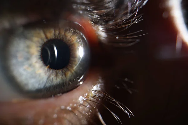 Laser Young Woman Closeup Eye Visiting Ophthalmologist Vision Correction — ストック写真