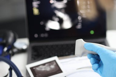 Doktor ultrasonik sondayı kontrol için elinde tutuyor. İç organ konseptinin ultrasonu