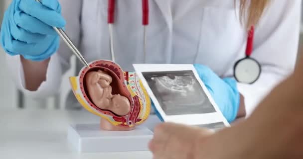 Obstetrician Gynecologist Shows Woman Artificial Model Fetus Child Ultrasound Fetus — Stockvideo