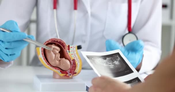Gynecologist Shows Anatomical Model Uterus Fetus Close Specialist Consultation Preparation — 图库视频影像
