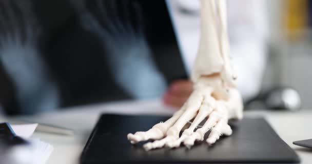 Anatomisches Modell Des Beines Auf Dem Tisch Nahaufnahme Konsultation Eines — Stockvideo