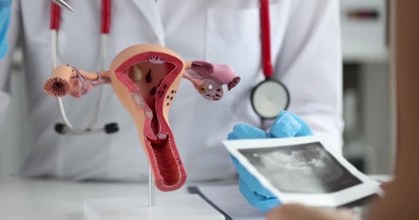 Doctor Points Pen Anatomical Model Female Reproductive System Pregnancy Planning — ストック動画