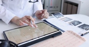 Kardiyolog tabletteki hastanın kalbinin elektrokardiyogramını inceliyor. Kalp hastalığı semptomları ve belirtileri