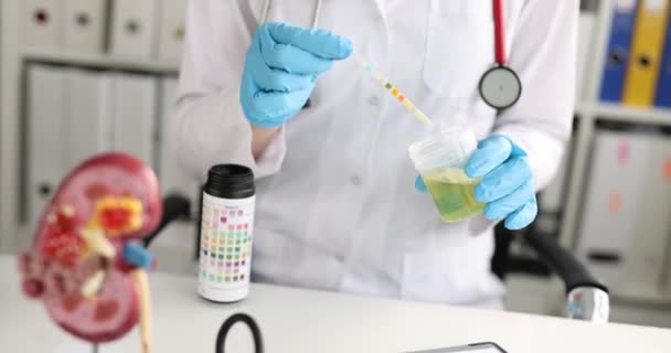 Medizinische Untersuchung Der Hand Mit Streifen Zur Urinanalyse Analyse Mikrobiologischer — Stockvideo