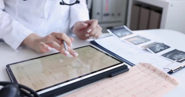 Cardiologist Examines Electrocardiogram Patient Heart Tablet Symptoms Signs Heart Disease — стоковое видео