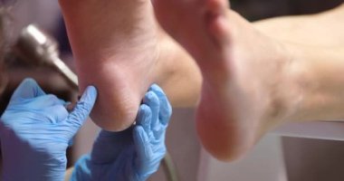 Ayak tabanlarındaki deriyi cilalayan pediatrist 4K yakın çekim filmi. Çatlamış ayaklar ve kuru nasırlar tedavisi