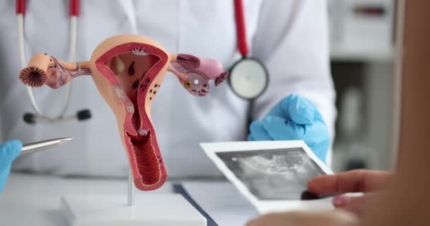 Anatomical Model Female Reproductive System Close Consultation Gynecologist Ultrasound Uterus — стоковое видео