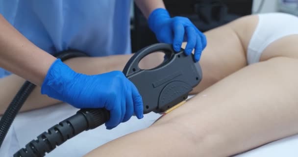 Dermatologist Laser Device Womans Legs Close Hardware Removal Venous Mesh — Vídeo de stock
